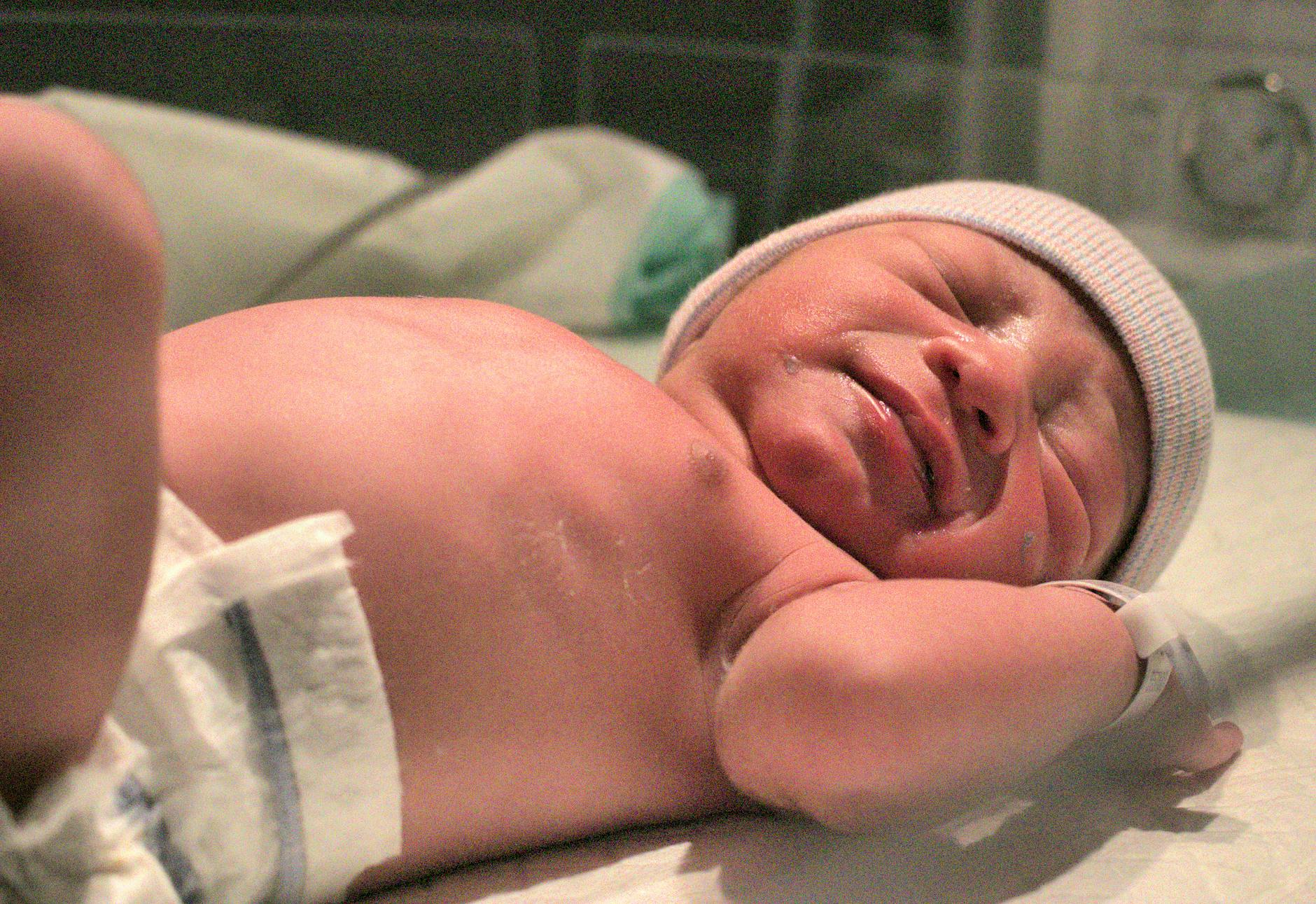 Detailansicht: Meningokokken Baby