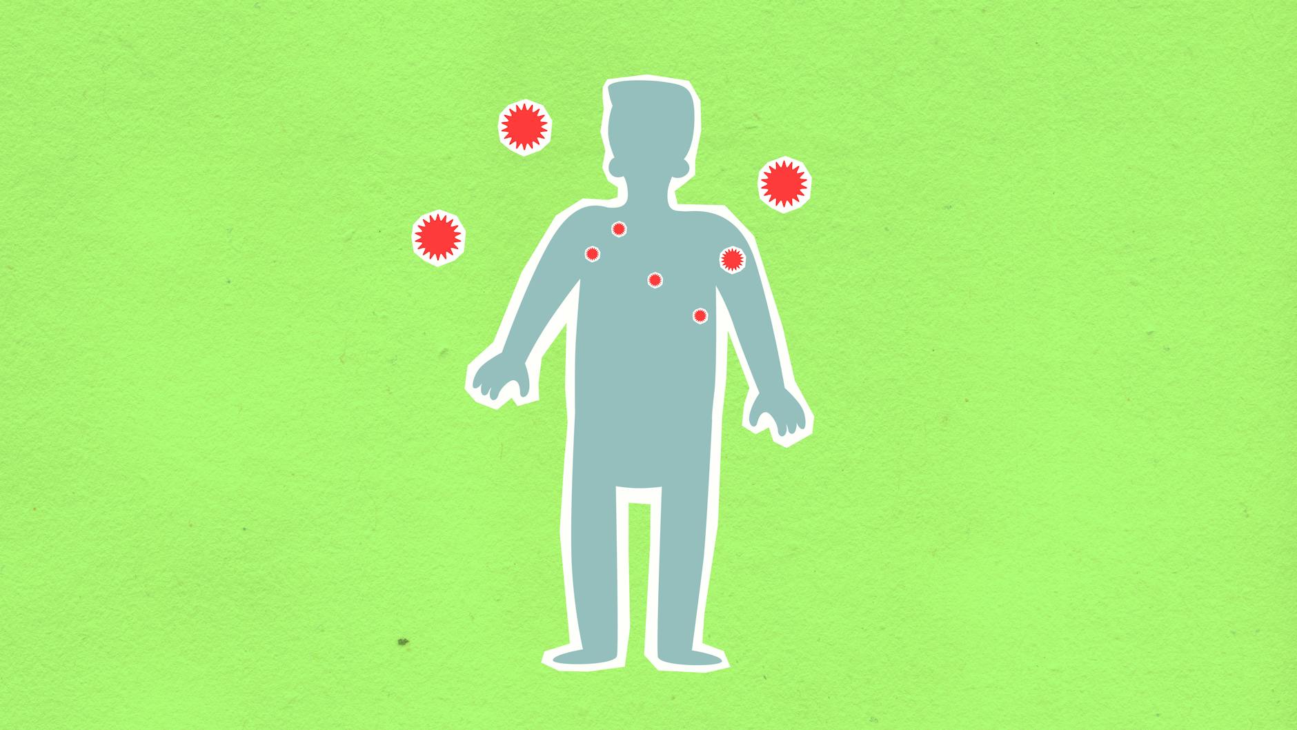 Illustration zu Borna Disease Virus
