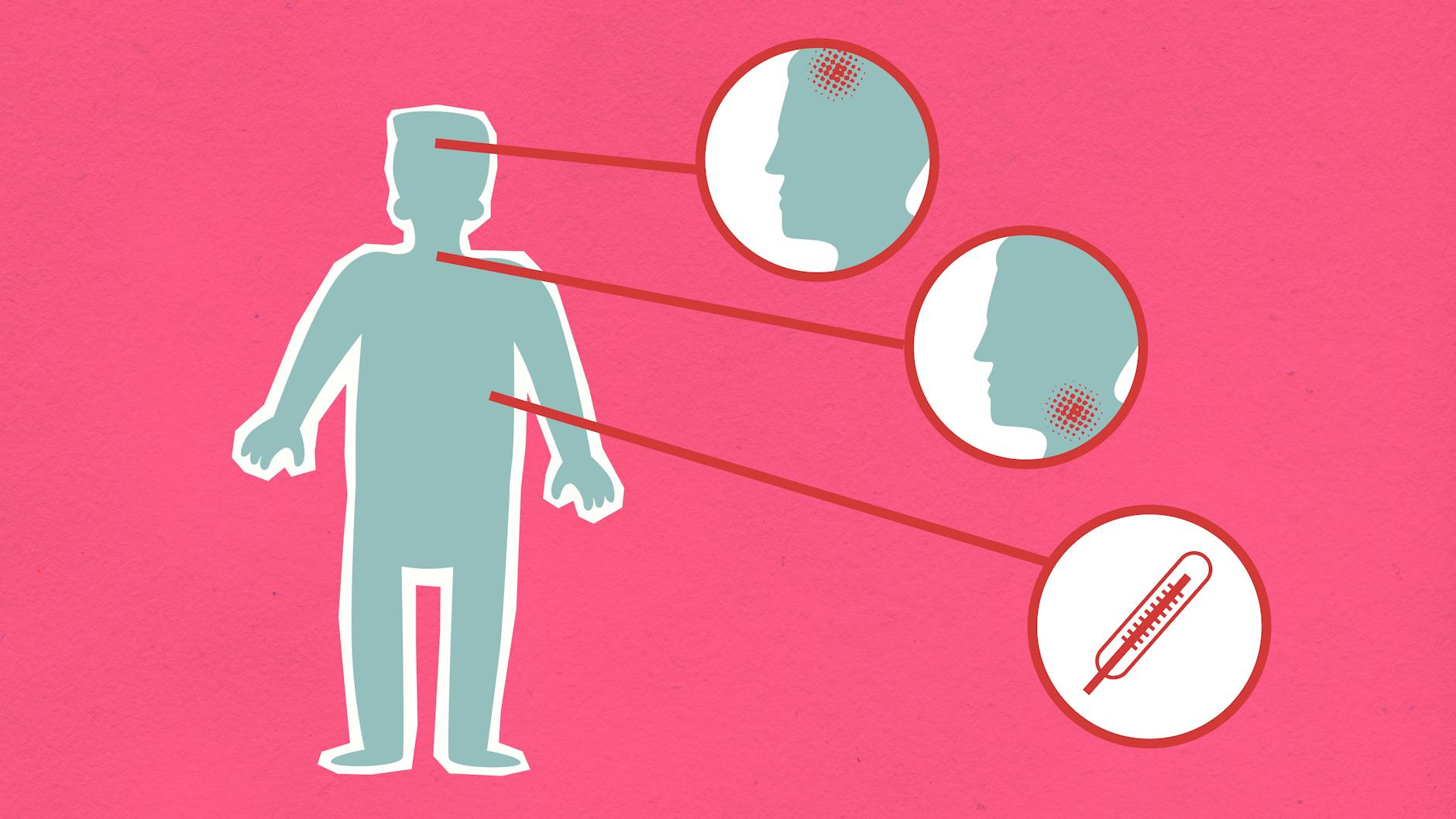Detailansicht: Borna Disease Virus